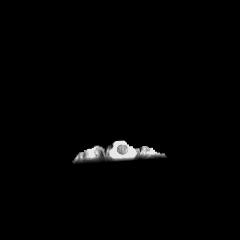 Cover image for Using AI & MRIs to diagnose Brain Tumours